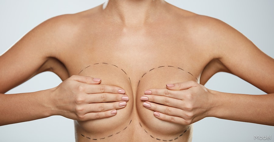 Meet a good modern professional who offers you Breast implants Miami